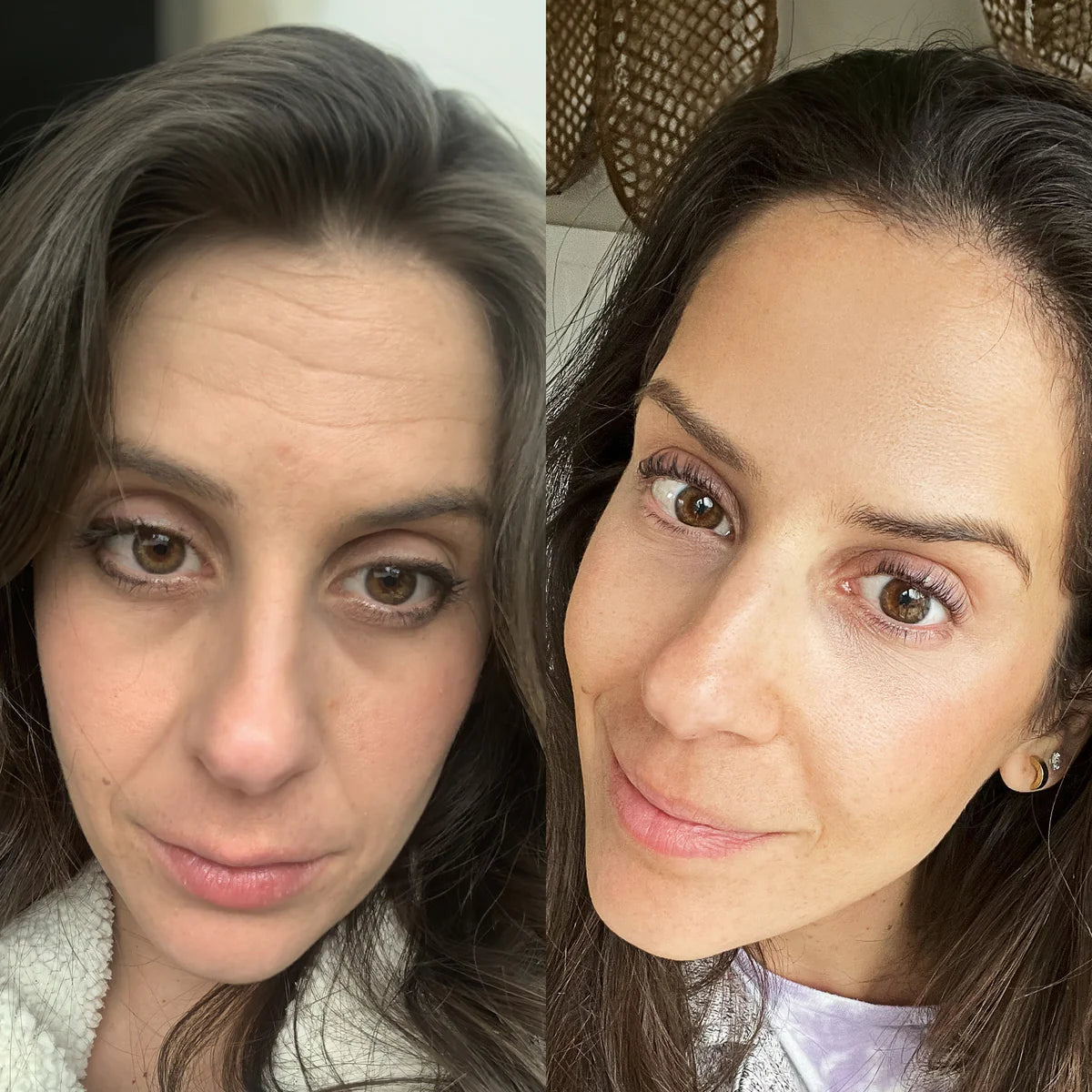 Clarvée FaceRevive® — Varita 4 en 1 para el cuidado de la piel