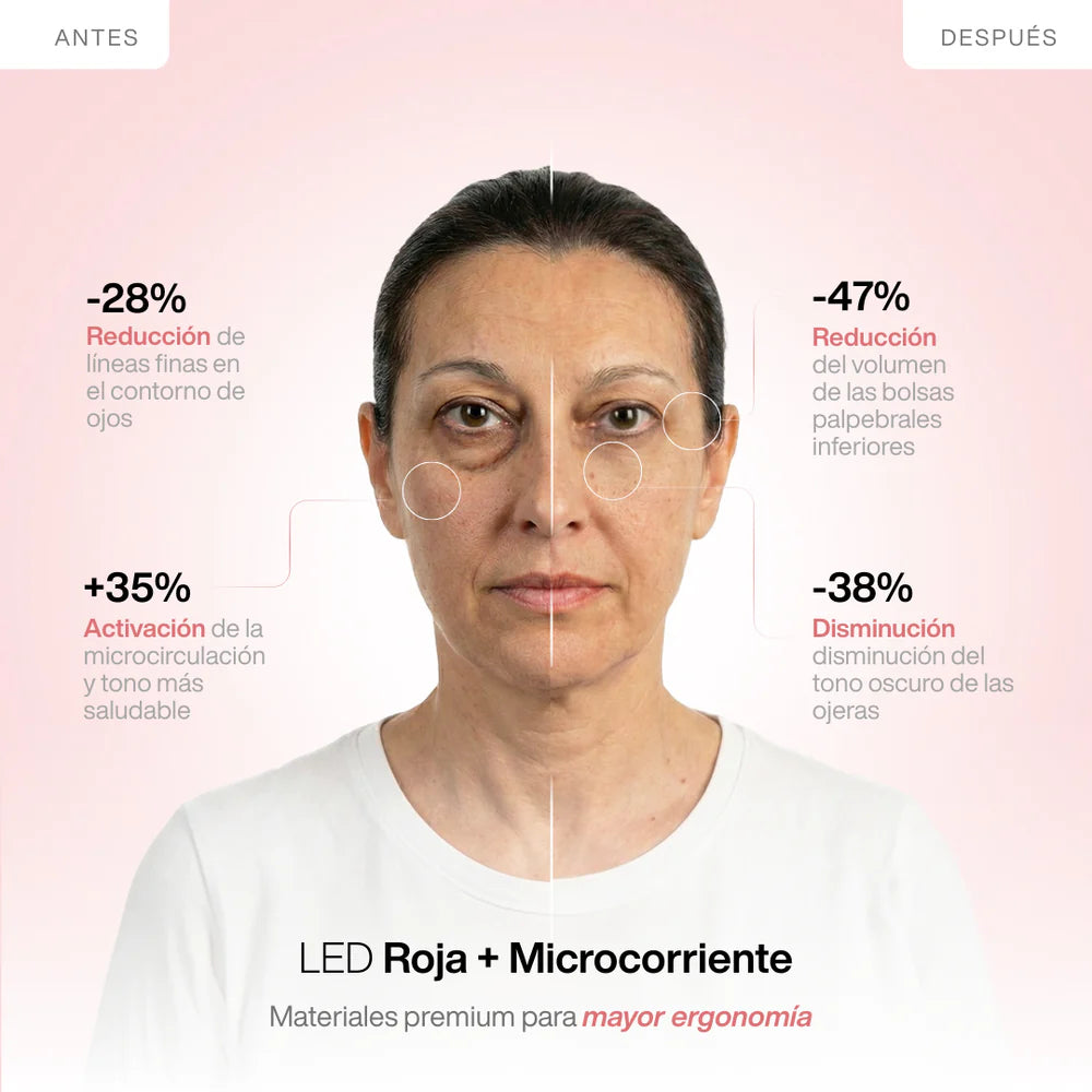 Clarvée EyeRevive® — Terapia LED + EMS para Eliminar Bolsas y Ojeras