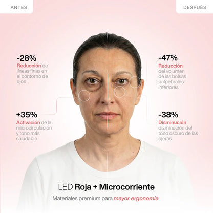 Clarvée EyeRevive® — Terapia LED + EMS para Eliminar Bolsas y Ojeras