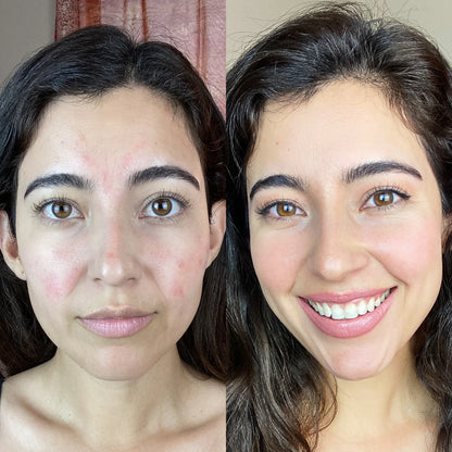 Clarvée FaceRevive® — Varita 4 en 1 para el cuidado de la piel