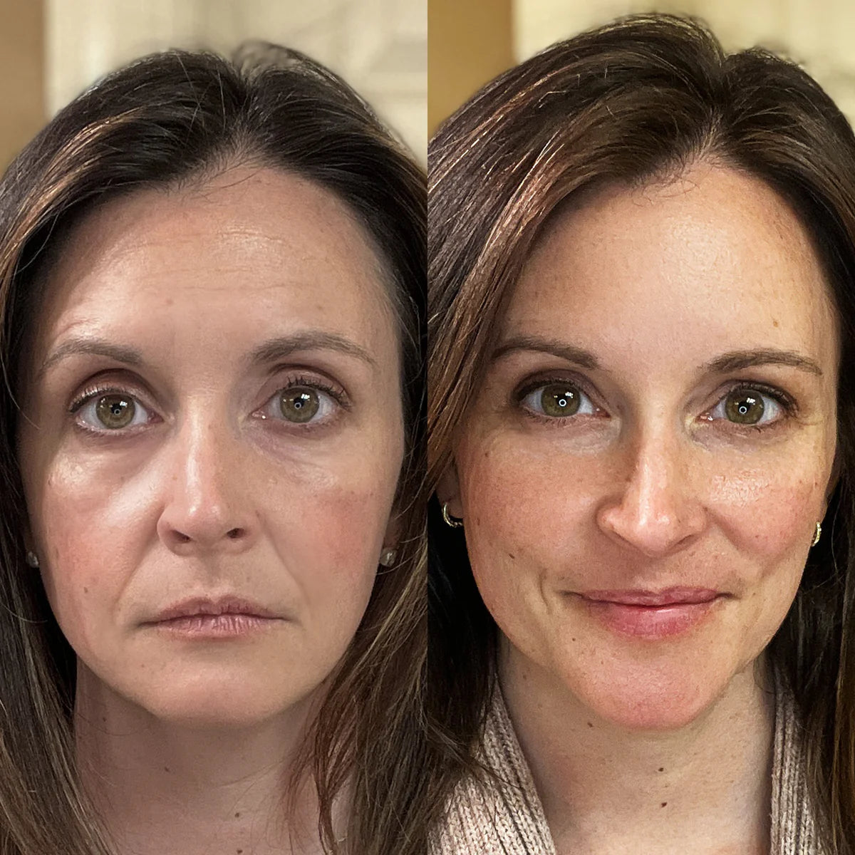 Clarvée FaceRevive® — Varita 4 en 1 para el cuidado de la piel
