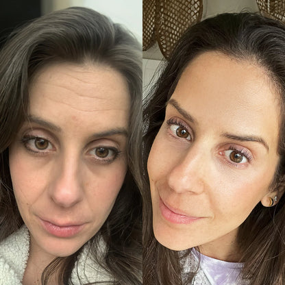 Clarvée FaceRevive® — Varita 4 en 1 para el cuidado de la piel