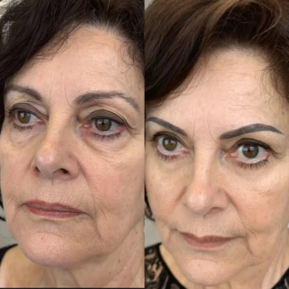 Clarvée EyeRevive® — Terapia LED + EMS para Eliminar Bolsas y Ojeras